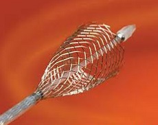 The Carotid Wallstent Monorail Endoprosthesis from Boston Scientific. 2013 Boston Scientific Corporation or its affiliates. All rights reserved. Used with permission of Boston Scientific Corporation.